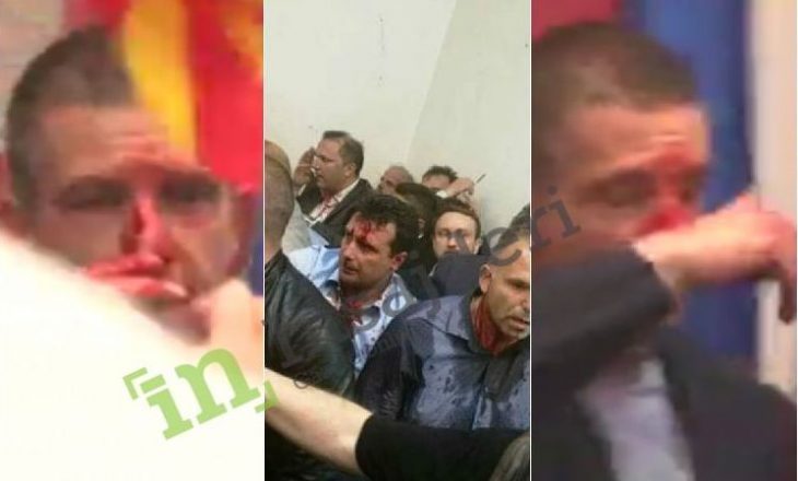 Të tërhequr zvarrë – fytyrat e përgjakura të deputetëve në Maqedoni