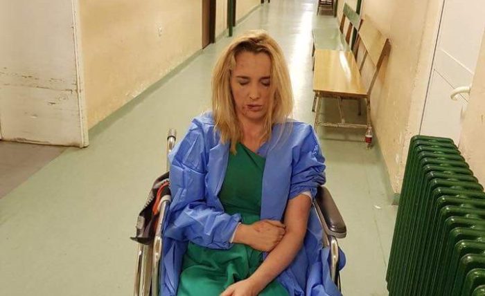 Policia ende s’e di kush e sulmoi Arbana Xharrën