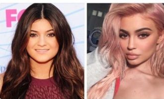 Plot shaka për operacionet plastike të Kylie Jenner