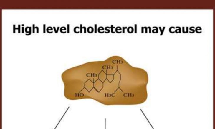 Një ilaç i ri kundër kolesterolit