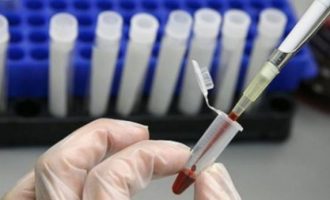 Durrësi alarmohet nga Tuberkulozi