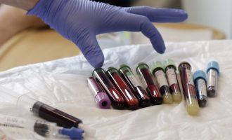 Mënyra më e re që të luftohet kanceri