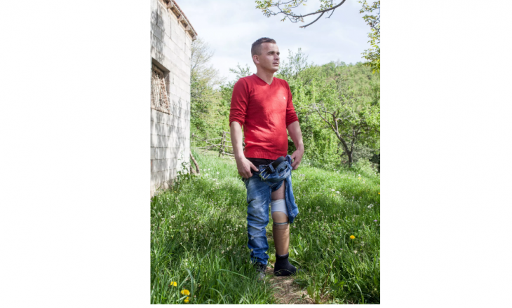 Historia e kosovarit që humbi këmbën gjatë luftës dhe veprimi i tij që frymëzoi të tjerët