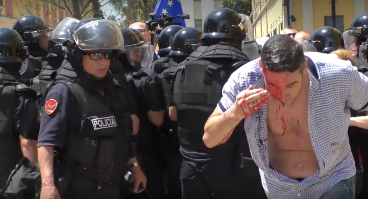 Pamje nga protesta e përgjakshme në Shqipëri [VIDEO]