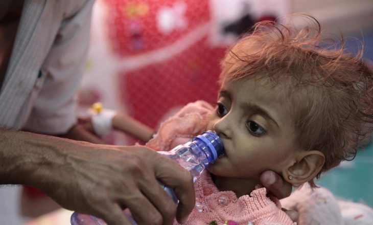 Në Jemen kanë vdekur nga uria 85.000 fëmijë deri në pesë vjeç