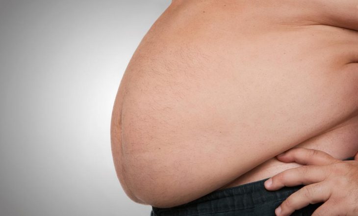 Pse është rritur obeziteti në vitet e fundit?