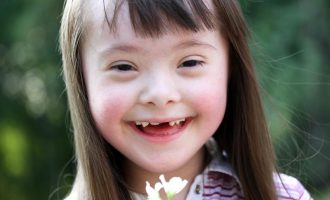 Skandaloze: Teksti shkollor ”Biologjia” i quan ”idiotë”, ”mongoloidë” dhe që ”jetojnë 10-16 vjet” personat me sindromin Down