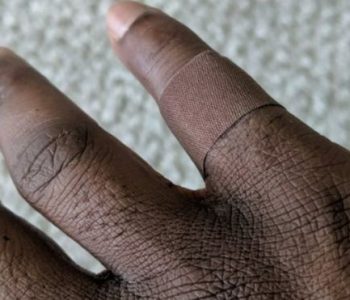 Debati racist dhe emocionues për një fllaster: A duhet të përshtatet me tonin e lëkurës?