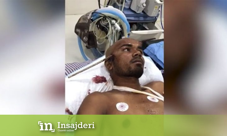 Armatura ia ka shpërthyer kafkën, ai bën muhabet derisa pret operacionin