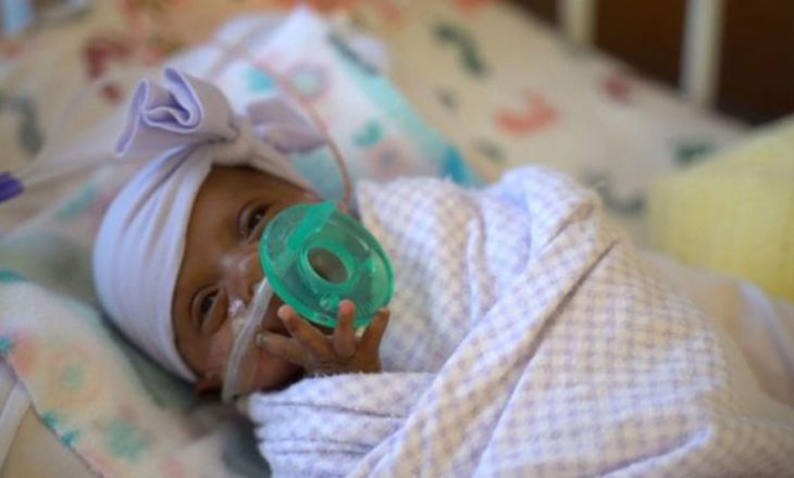 U lind sa një kokërr mollë, lirohet nga spitali foshnja me e vogël në botë