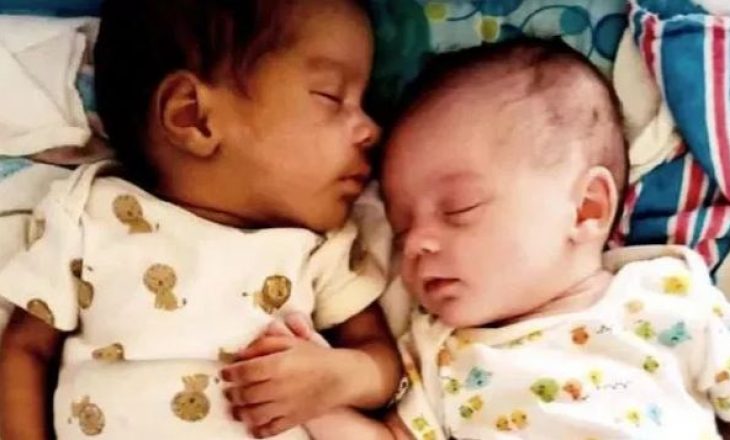 E rrallë, nëna sjell në jetë binjakë me ngjyrë të ndryshme (FOTO)