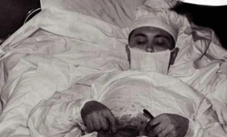 Historia e pabesueshme e kirurgut që operoi veten e tij