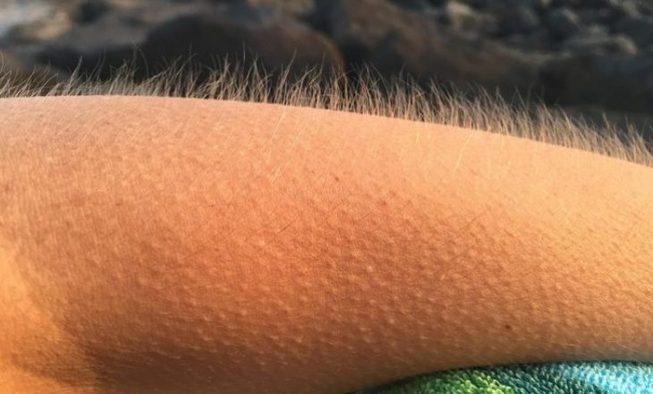Pse keni të ftohët tërë kohën dhe si ta ndalni këtë