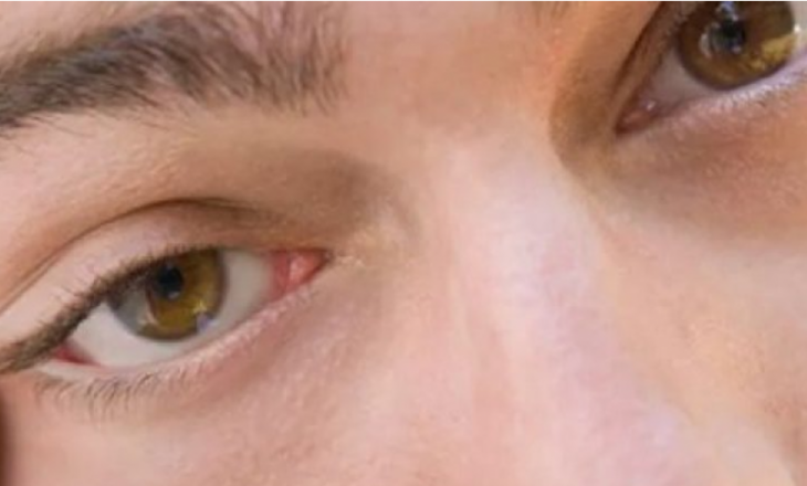 Përse dridhet syri? Ky është shpjegimi shkencor