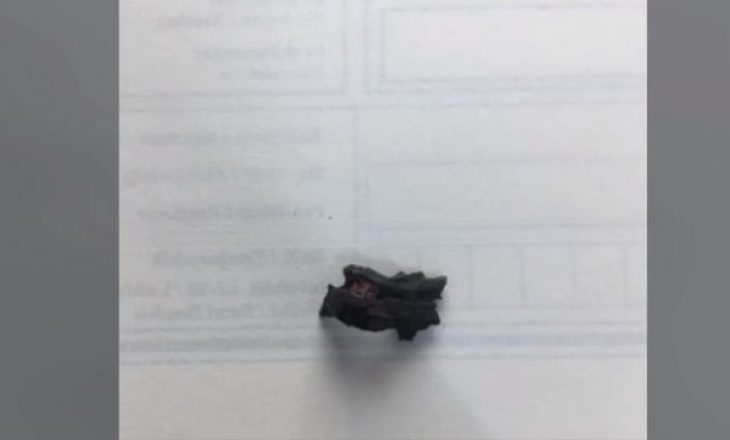 Pas 22 vitesh, ish-ushtari i UÇK-së largon copëzën e granatës nga trupi