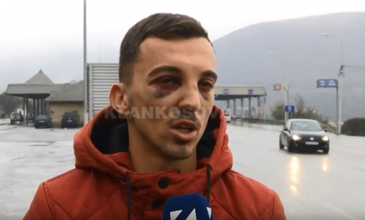 Tre kosovarë i rrahin brutalisht në Shkup – dalin pamjet