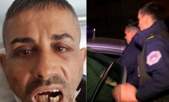 Pamje: Kallëzimi penal ndaj tre policëve dhe tmerri që përjetuan dy qytetarët që festuan fitoren e Vetëvendosjes