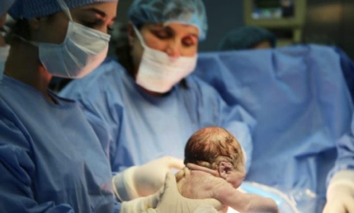 E pazakontë: Fëmija lind “me bisht”, publikohen fotografitë