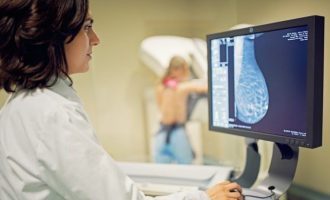 Inteligjenca artificiale e Google zbulon me saktësi më të lartë sesa njeriu kancerin e gjirit