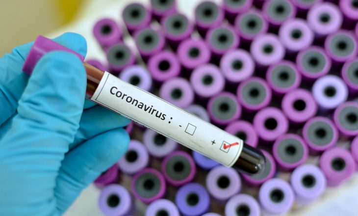 Six new Coronavirus-related deaths, 309 new cases