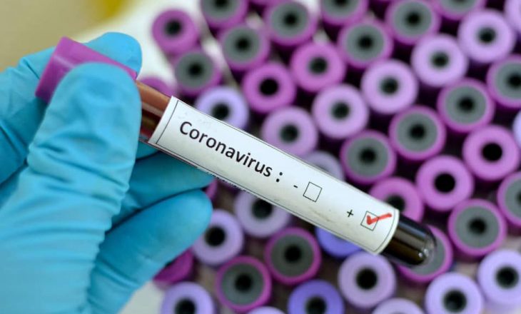 Konfirmohet rasti i parë me koronavirus në Kroaci