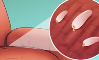 4 shenjat që dysheku dhe kolltuku juaj kanë insekte dhe ka ardhur koha t’i ndërroni