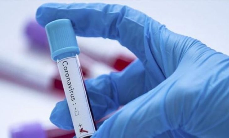 ​Odat ekonomike do të flasin për masat e ndërmarra për Covid 19