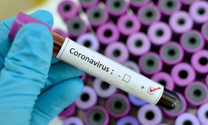 Dyshohet edhe për 4 raste të reja me coronavirus në Kosovë