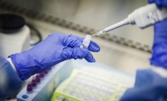 COVID-19 po bëhet agresiv në Kosovë