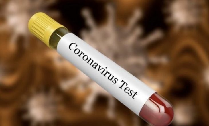 Tani testin për koronavirus mund ta blini online