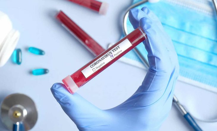 Nëse infektoheni me koronavirus, thonë shkencëtarët, përdorni paracetomal, jo brufen