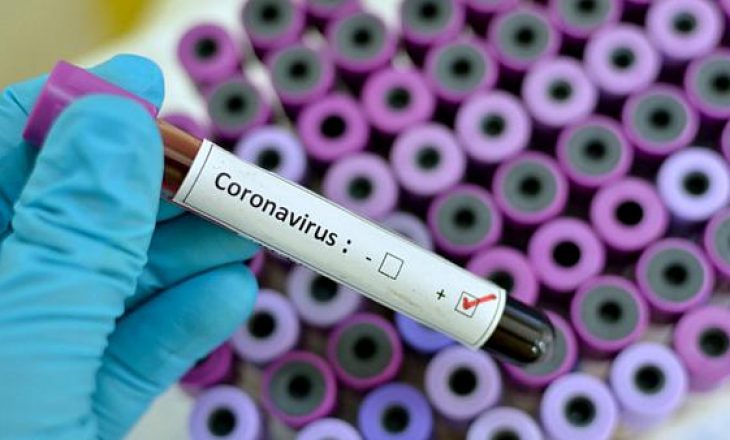 Adoleshenti që bëri një “coronavirus party” u infektua me Covid-19