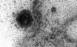 Hulumtuesit brazilian publikojnë pamje – coronavirusi duke u futur në një qelizë të njeriut të cilën më pas e infekton