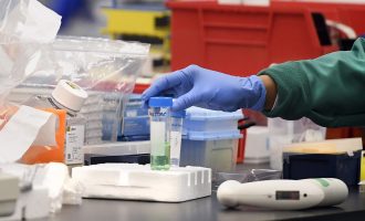 Katër të vdekur dhe 145 raste të reja me COVID-19 në Mal të Zi