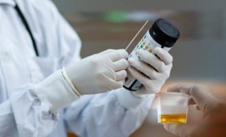 Edhe ngjyra e urinës mund të tregojë infeksionin me koronavirus