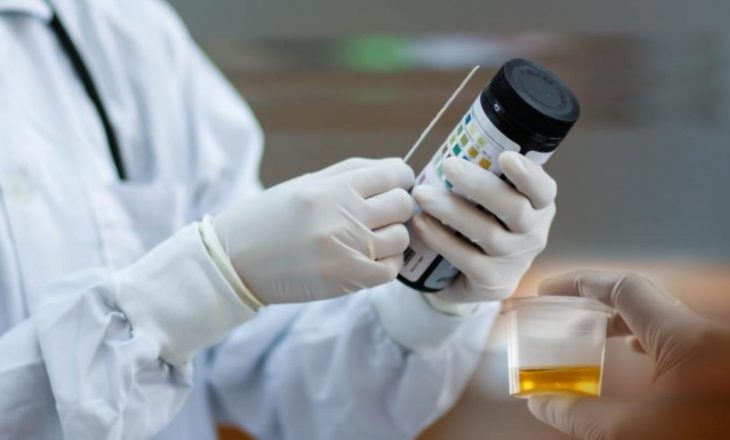 Edhe ngjyra e urinës mund të tregojë infeksionin me koronavirus