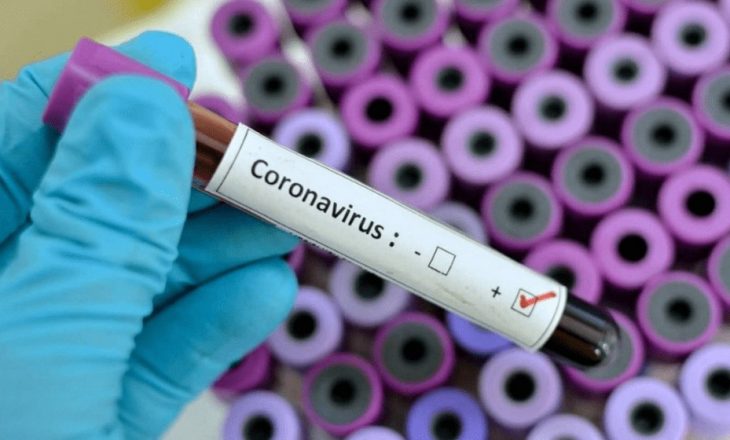 Ndërron jetë një shqiptar nga coronavirusi në Maqedoni