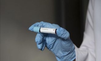 Brenda një dite testohen 168 punëtorë shëndetësorë, 64 prej tyre rezultuan pozitiv me COVID-19