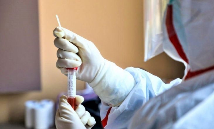 ​87 viktima të reja nga koronavirusi në Turqi