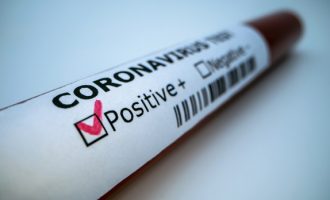 Teste për COVID-19 së shpejti edhe në privat