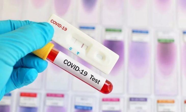 Licencohen edhe dhjetë laboratorë privatë për teste të Covid-19
