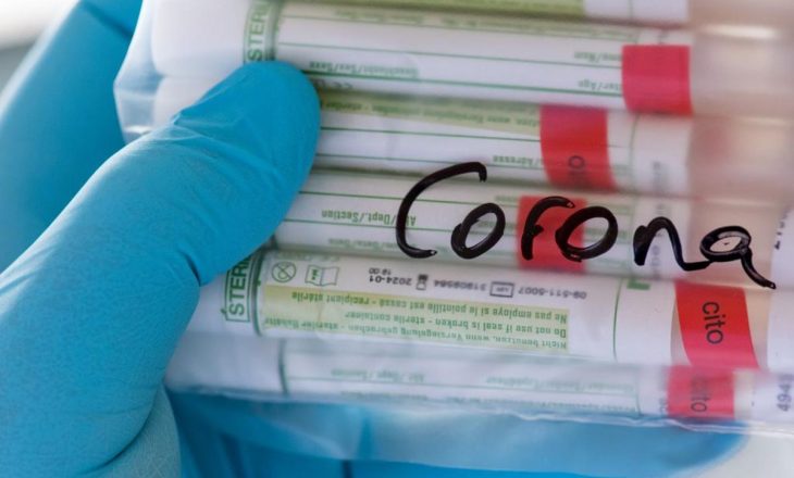 Ekspertët shëndetësorë për të infektuarit me COVID-19: Shifrat janë shumë më të mëdha se sa raportohen