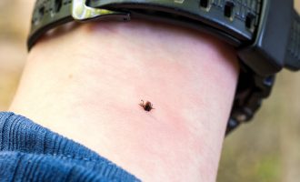 Çfarë të bëjmë kur pickohemi nga rriqrat?