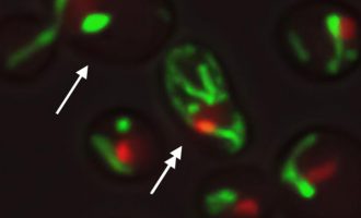 Shkenca është afër zbulimit që do të mundësojë shtyerjen e procesit të plakjes