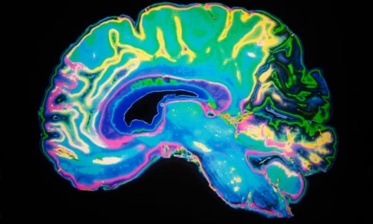 Neurologët paralajmërojmë çrregullime serioze të trurit te njerëzit me simptoma mesatare të Covid-19