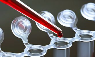 A ka lidhje mes grupit të gjakut dhe rrezikut për t’u infektuar me COVID-19?