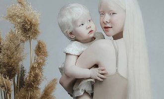 Motrat albine me 12 vjet diferencë kërkohen si modele pasi mahnitën internetin me fotot e tyre