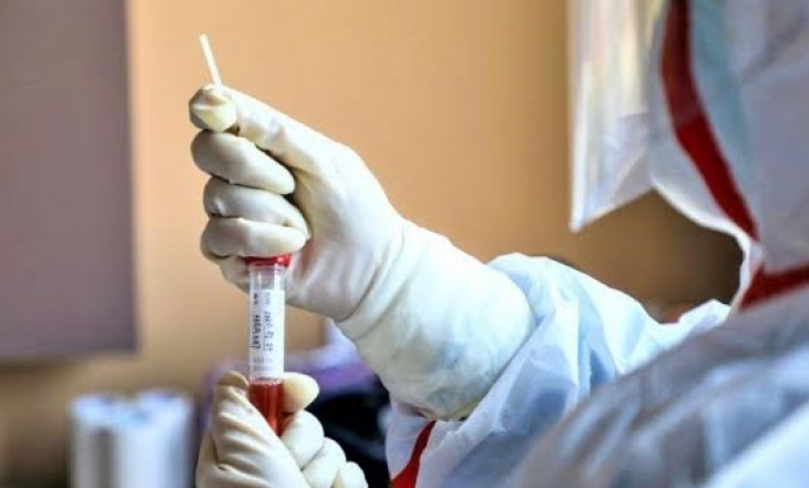 Gjashtë të vdekur dhe 574 raste të reja me Coronavirus në Shqipëri