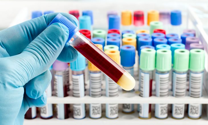 Testet serologjike s’janë për diagnostikim të COVID-19, janë për hulumtime