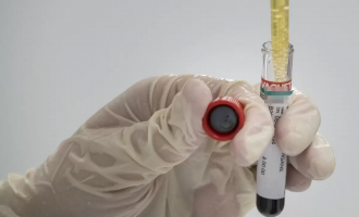 Rreth 13% të testeve serologjike në Prishtinë rezultojnë pozitive